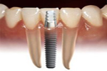 perfect smile by Bangkok Dental Hospital